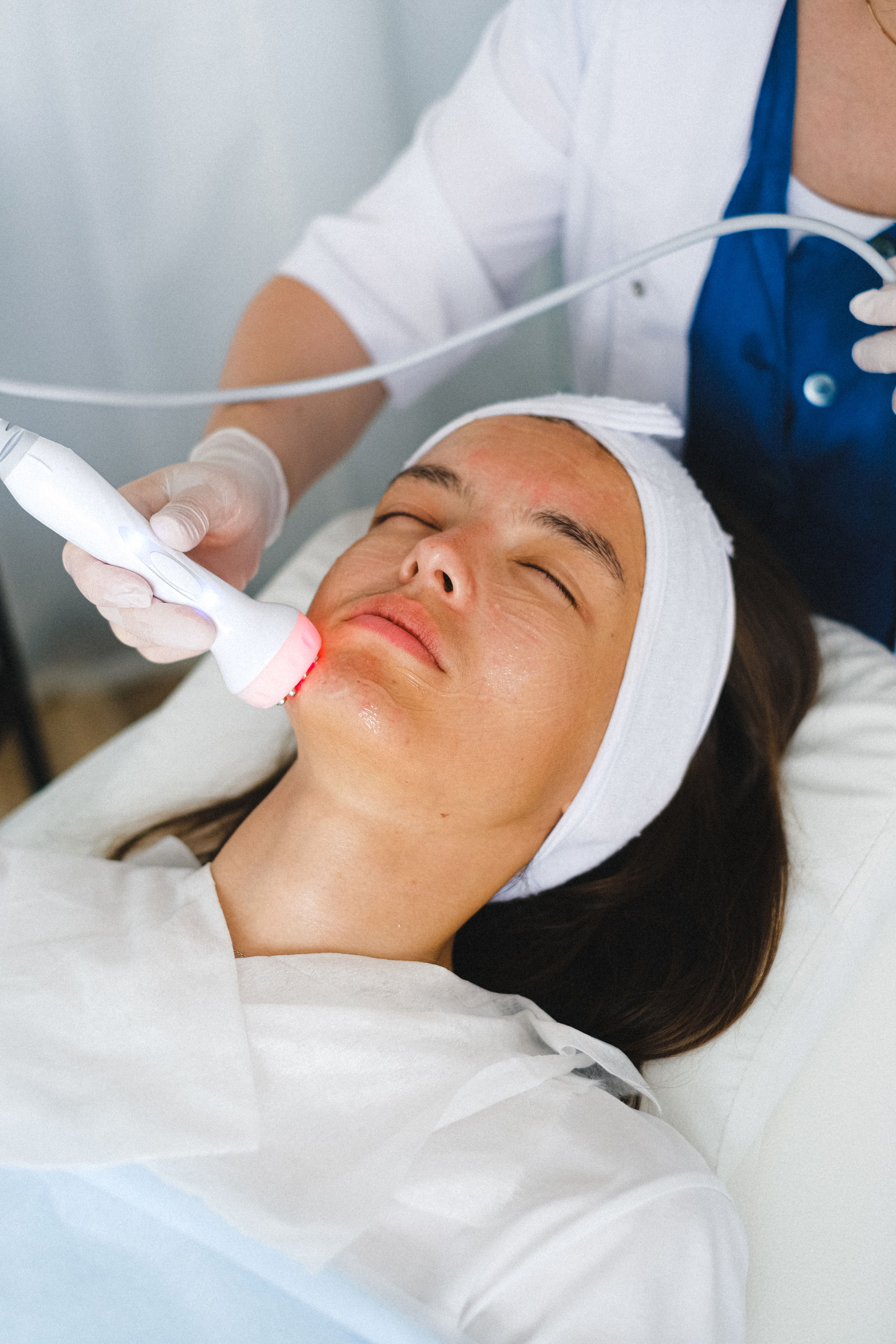 Ultrassom Microfocado Facial